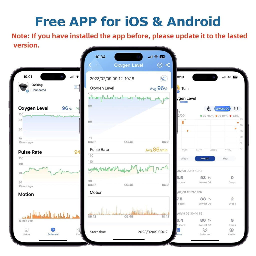 Wellue O2Ring Oxygen Monitor with Vibration Reminder -Bluetooth O2 Pulse Oximeter Rechargeable, Continuous Recording of SpO2 & PR, Blood Oxygen Saturation Tracker with Free APP & PC Reports