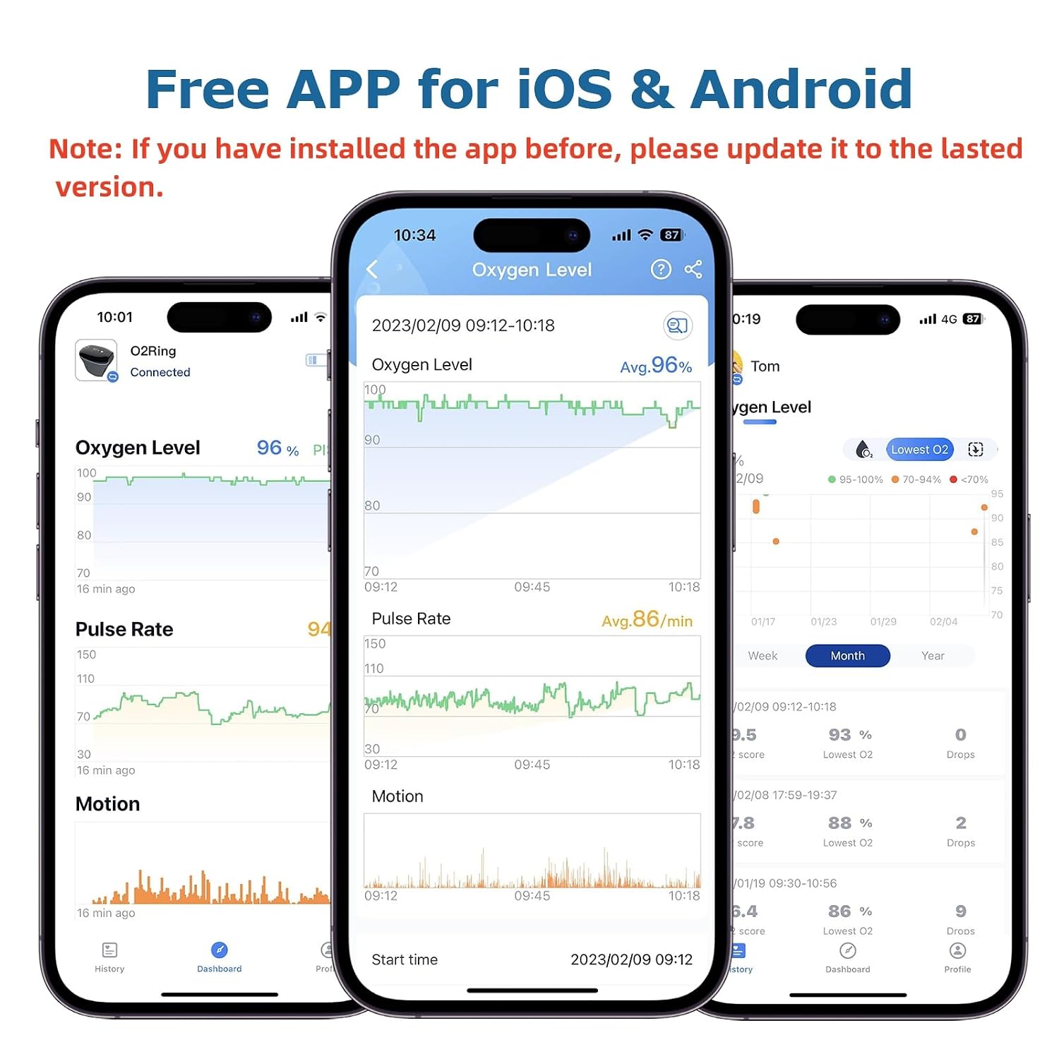 Wellue O2Ring Oxygen Monitor with Vibration Reminder -Bluetooth O2 Pulse Oximeter Rechargeable, Continuous Recording of SpO2 & PR, Blood Oxygen Saturation Tracker with Free APP & PC Reports